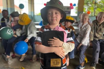 Türk STK'ler Tanzanya'daki albino çocuklara bayram sevinci yaşattı
